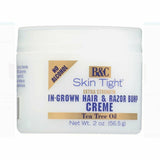 B & C Body Cream B & C: Skin Tight Ingrown & Razor Bump Creme 2oz